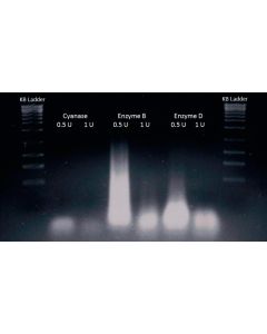 Nucleic Acid Removal Kit